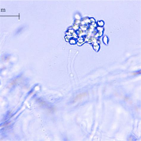 Albugo Candida 1 000 Reiterations Download Scientific Diagram