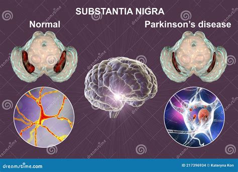 Substantia Nigra Midbrain