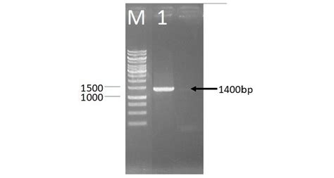 Agarose Gel 1 Electrophoresis Showing Amplified 16s Rrna Gene Of Lab