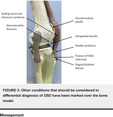 Tibial Tuberosity Lesions Sciencedirect