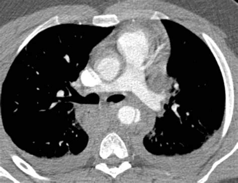 Radrounds Radiology Network On Twitter Diagnosis