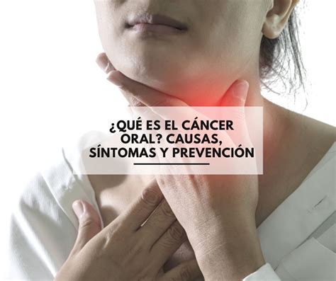 Qu Es El C Ncer Oral Causas S Ntomas Y Prevenci N Centros