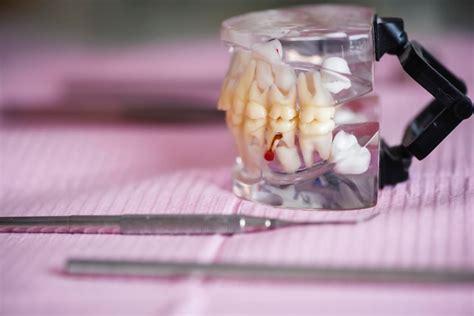 Premium Photo | Dental prosthesis