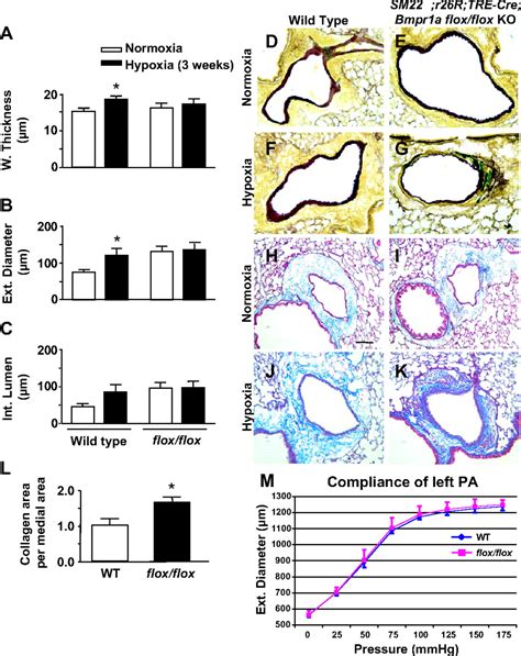 Smooth Muscle Protein 22αmediated Patchy Deletion Of Bmpr1a Impairs