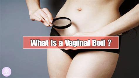 What Is A Vaginal Boil Youtube