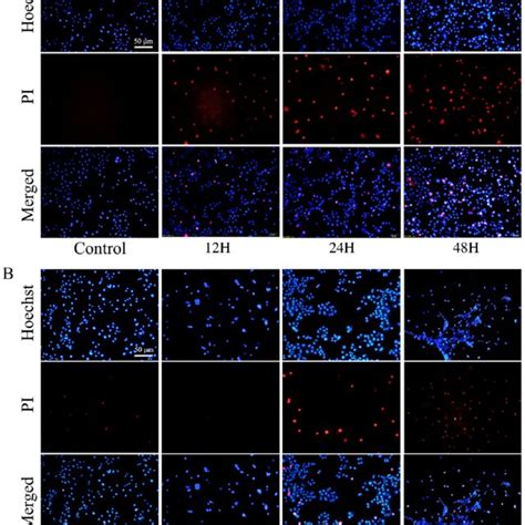 Pyroptosis In HPDE6C7 Cells As Observed By Hoechst PI Staining