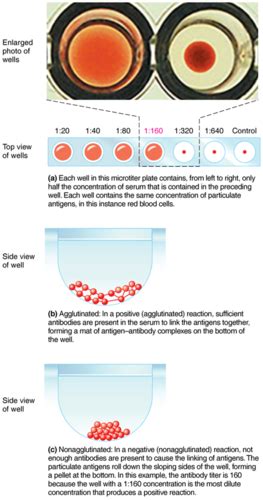 Microbiology Chapter Flashcards Quizlet