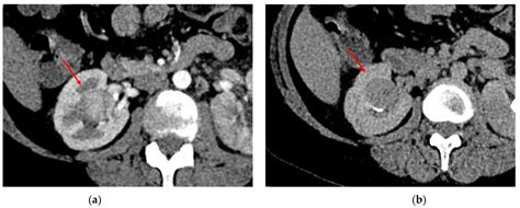 Diagnostics Free Full Text The Role Of Ct Imaging In