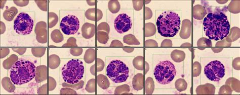 Basophils with some thicc granulation 🍪 : r/medlabprofessionals