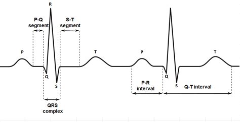 Ecg Diagram Quizlet