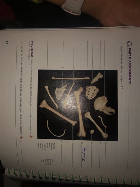 Solved Part D Assessments Identify The Bones Indicated In Chegg