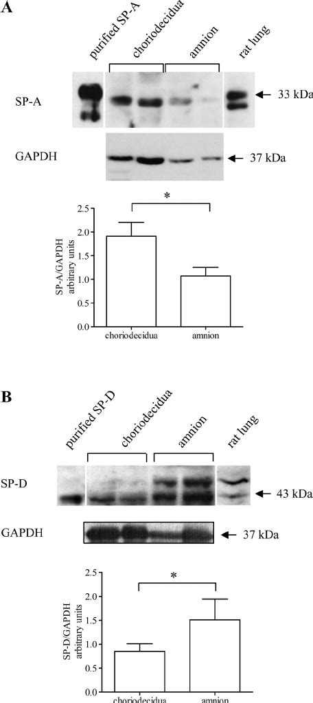 Mrna Expression Of Surfactant Protein Sp A Sp A And Sp D In