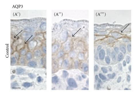 Representative Images Of Immunoperoxidase Localization Of Aqp In M