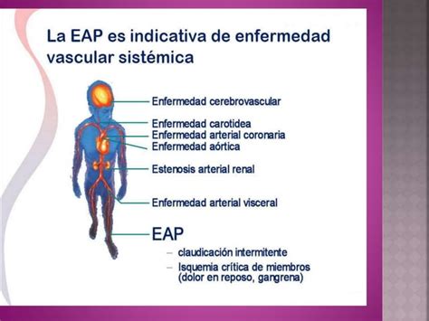 Manejo Actual De La Insuficiencia Arterial Aguda Y Cr Nica Ppt