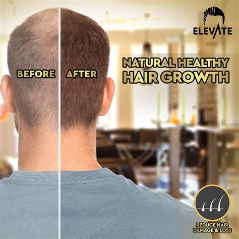 Elevate Hair Growth Oil Biotin And Castor Oil Serum For Stronger Thicker Hair Growth Prevent