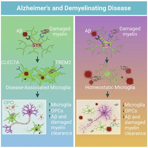 Brain Discovery Holds Key To Boosting Body S Ability To Fight Alzheimer