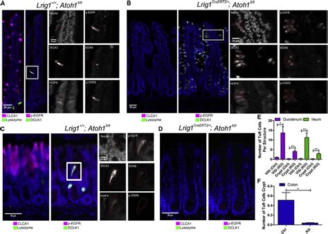 Tuft Cells Have Alternative Specification Requirements in Small ...