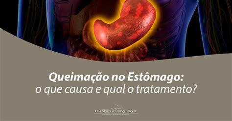Queimação No Estomago E Gases - Queimação No Estômago: O Que Causa E Qual O Tratamento? - Prof Dr. Luiz ...