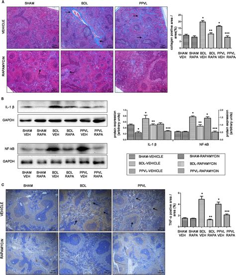 Effects Of Rapamycin On Fibrosis And Inflammation In Splenic Parenchyma Download Scientific