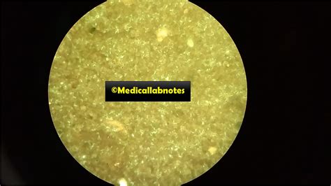 Auramine Phenol Stain Introduction Principle