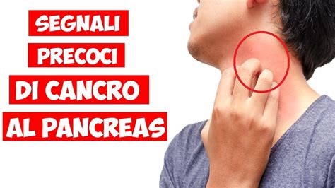 9 Segni Premonitori Del Cancro Al Pancreas Che Devi Sapere YouTube