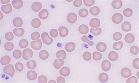 Normal Platelets Cells And Smears