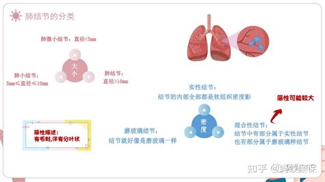 如果查出肺结节，这篇文章一定要看~ 知乎