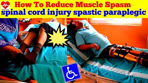 How To Reduce Spasticity For Spinal Cord Injury Paraplegic Youtube