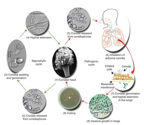 Aspergillus Fumigatus Infection