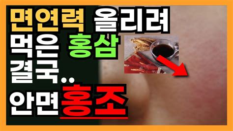 면연력 올리려 홍삼 먹었는데 결국 안면홍조피부과에서 지루성피부염 진단이런분들 홍삼 절대 먹지 마세요 홍삼 부작용 Youtube