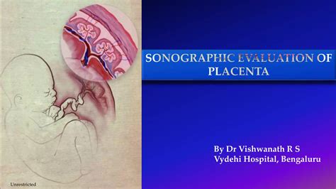 ultrasound imaging  placenta pptx