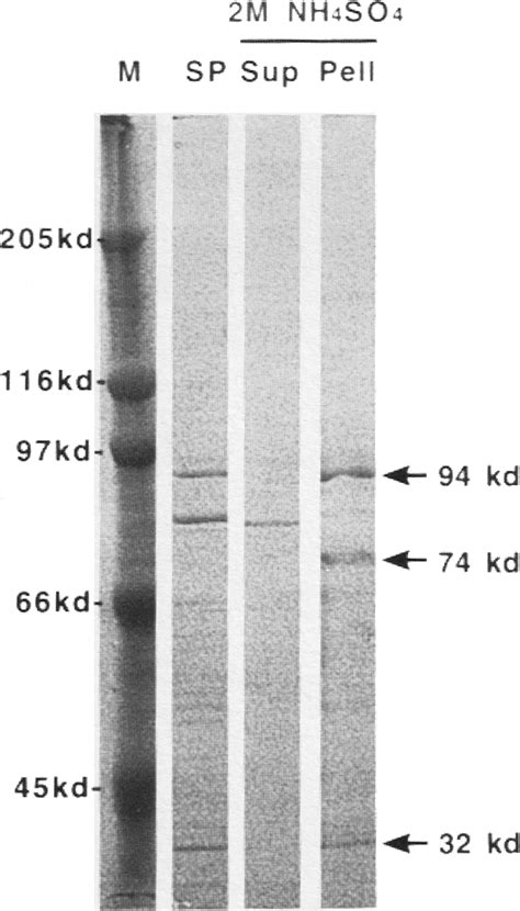 Ten Percent Sds Page Of 2 M Ammonium Sulfate Precipitation Pooled Download Scientific Diagram