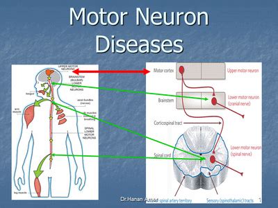 Diseases of the Anterior Horn Cell - Neurology for Physiotherapists