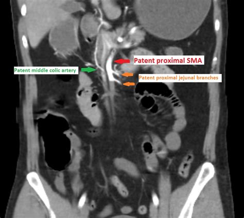 Image Radiopaedia Org