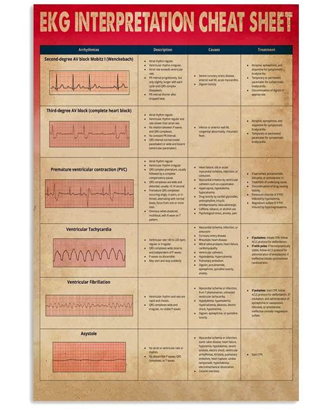 Cardiologist Ekg Interpretation Cheat Sheet Poster Nursing Labs Ekg Interpretation Ventricular