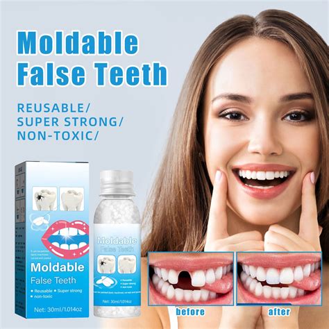 Sandistore Teeth Ning Toothpaste Gel Solid Filling Gel Cavity Filling Masquerade Dentures Gel