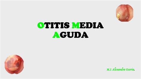 Otitis Media Aguda Osoria Udocz