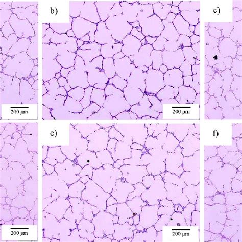 Microstructure Of A B And C As Cast And D E And F Homogenized