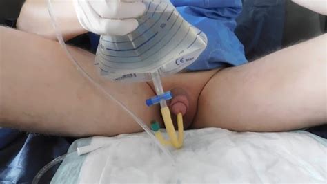 Filling The Bladder With An Inserted Catheter Ch Fr Xxx Mobile