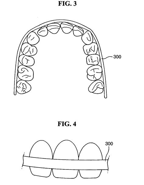 Mandibular teeth patented technology retrieval search results - Eureka