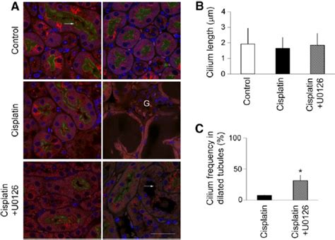 Preservation Of Cilia By U0126 In Dilated Kidney Tubules During