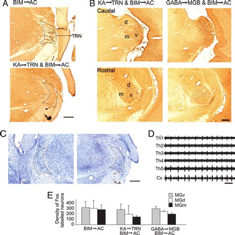 Involvement Of TRN A Photomicrographs Show C Fos Expression In The