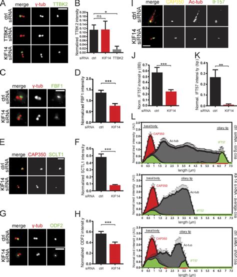 Kif14 Knockdown Affects Bb Components And Ift B Anterograde Transport Download Scientific