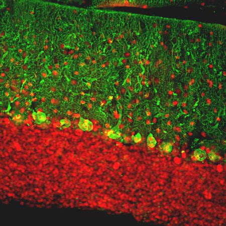 Chicken Polyclonal Antibody To NF H Cat CPCA NF H EnCor Biotechnology