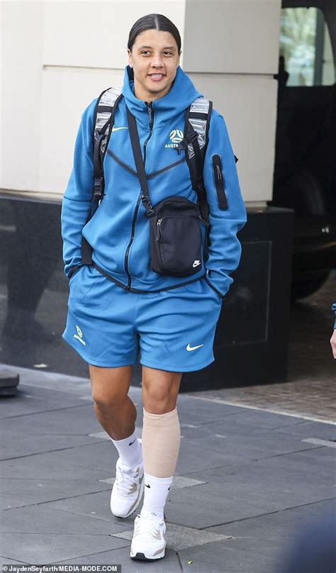 Sam Kerr Emerges With Bandaged Calf And A Noticeable Limp After Shock