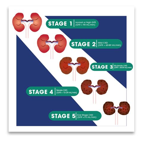 CHRONIC KIDNEY DISEASE (CKD)