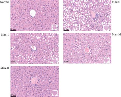 Man Improves Hepatic Steatosis In Hfd Induced Nafld Mice A The H E