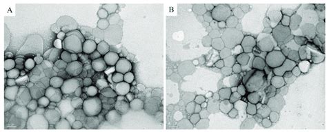 TEM Images Of The Nanostructured Lipid Carriers NLC A And UA NLC