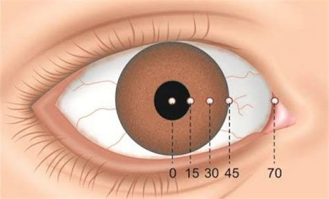 Diplopia Double Vision Physiological And Pathological Optography