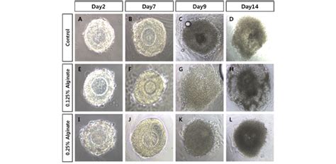 Development Of Preantral Follicles During In Vitro Culture Typical Download Scientific Diagram